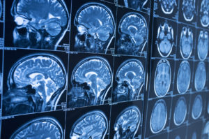 How Minner Vines Moncus Injury Lawyers Can Help You